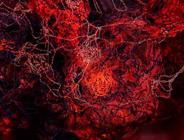 Web